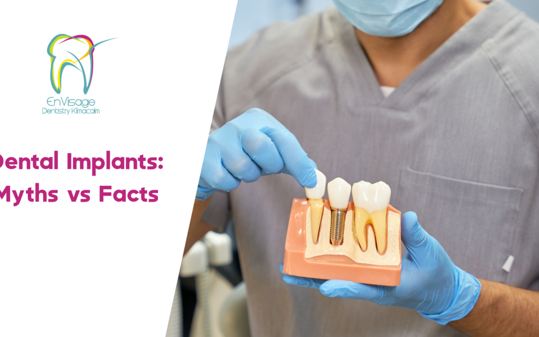 Dental Implants: Myths vs Facts