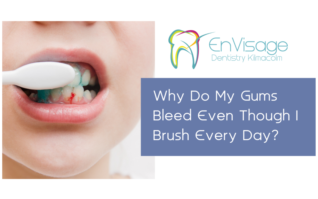 Why Do My Gums Bleed Even Though I Brush Every Day?