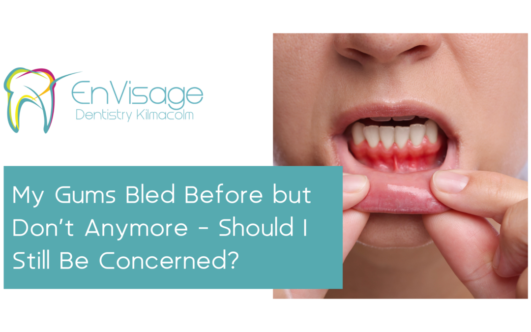 My Gums Bled Before but Don’t Anymore – Should I Still Be Concerned?