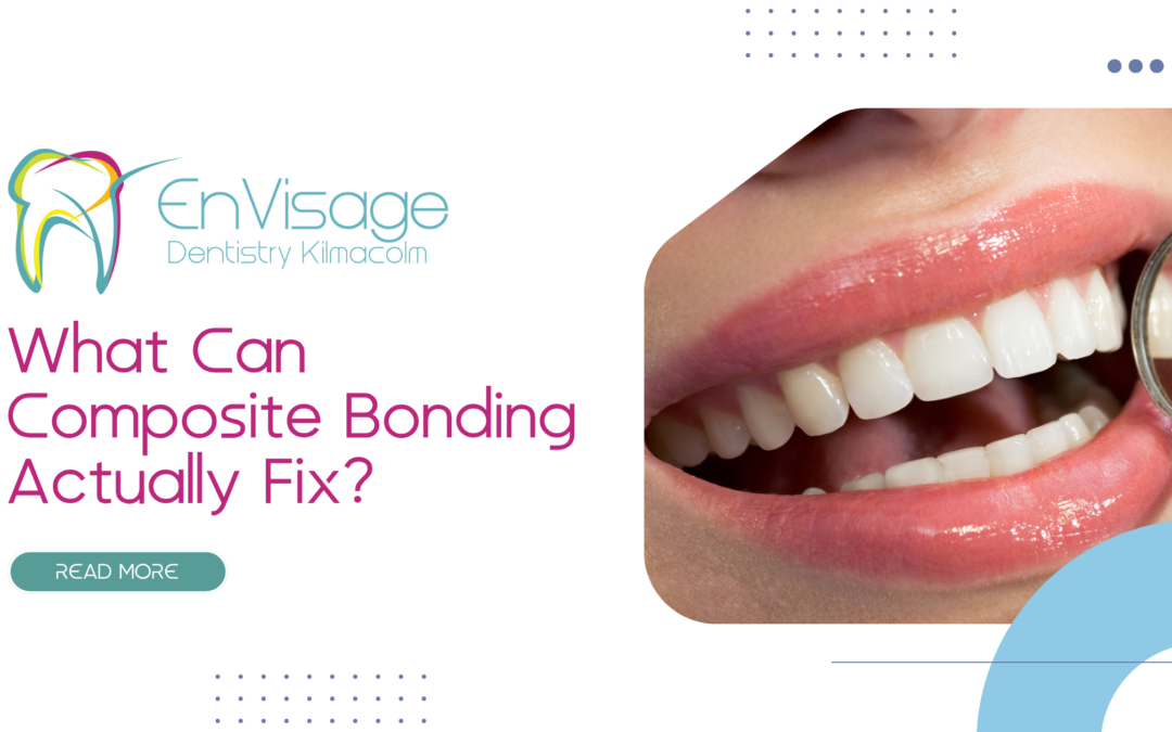 What Can Composite Bonding Really Fix and When Is It Not the Best Option?