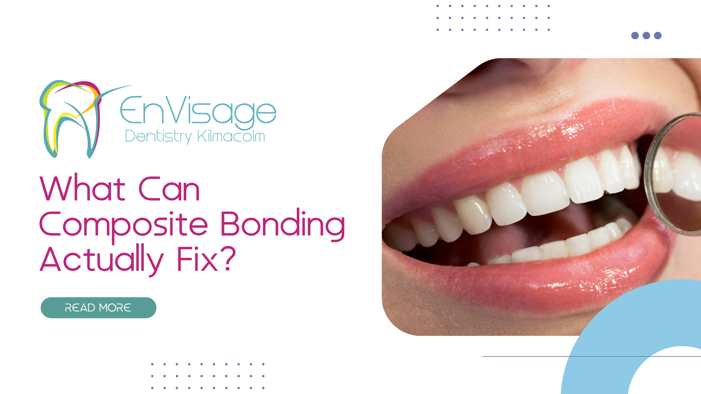 What Can Composite Bonding Really Fix and When Is It Not the Best Option?