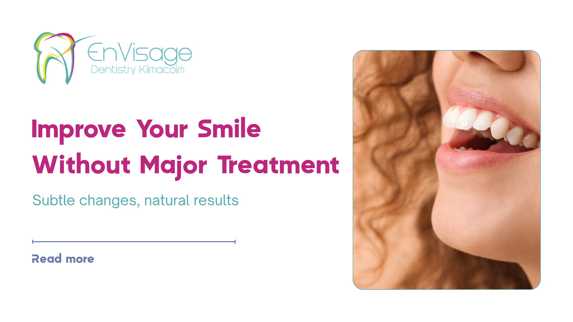 What’s the Best Way to Improve My Smile Without Major Treatment? | Envisage Dentistry Kilmacolm