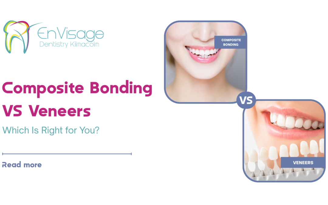 Composite Bonding vs Porcelain Veneers
